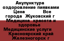 Акупунктура, оздоровление пиявками › Цена ­ 3 000 - Все города, Жуковский г. Медицина, красота и здоровье » Медицинские услуги   . Красноярский край,Железногорск г.